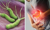 4 dấu hiệu chứng tỏ cơ thể có vi khuẩn HP, ăn 5 món vi khuẩn HP 'sợ nhất' để bảo vệ dạ dày