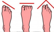 Tổ Tiên răn dạy: Ngón chân thứ hai dài hơn ngón cái, lớn lên không hiếu thuận, thực hư ra sao?
