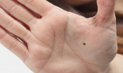 Ai sở hữu 3 nốt ruồi trên bàn tay này báo hiệu điềm lành, nhiều phúc khí cao sang, viên mãn
