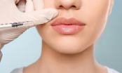 Xóa nếp nhăn bằng tiêm Botox và Filler - phương pháp nào an toàn và tốt hơn?