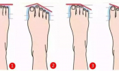 Bàn chân có 1 trong 6 đặc điểm này, người sở hữu mang số đại gia, chuẩn hơn nhìn mặt