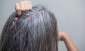 Phụ nữ tóc bạc ngày một nhiều, đừng vội nghĩ mình già, có thể là do cơ thể đang gặp phải 3 vấn đề