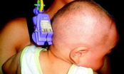Điểm tin mơi 16/9: Bất cẩn, bé sơ sinh 11 tháng tuổi bị đồ chơi cắm vào não