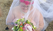 Kỳ lạ: Cô gái bị bệnh vi khuẩn ăn thịt người tỉnh dậy làm đám cưới nude