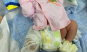 Vụ làm gãy xương đùi trẻ sơ sinh sau khi mổ đẻ: Bệnh viện chính thức lên tiếng