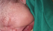 Vừa chào đời bé gái đã có 2 chiếc răng cửa khiến bác sĩ và gia đình kinh ngạc