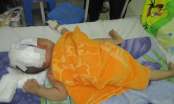 Thương tâm: Bé trai 15 tháng tuổi bị văng khỏi xe máy, chấn thương sọ não