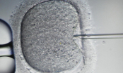 Bé sơ sinh thụ tinh trong ống nghiệm có 3 cha mẹ chào đời khỏe mạnh