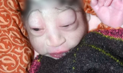 Bé sơ sinh bị mẹ bỏ rơi, không cho bú vì có ngoại hình giống người ngoài hành tinh