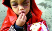 Bé trai 6 tuổi bị bố đánh dã man, ngủ gầm xe ô tô không dám về nhà vì nguyên nhân bất ngờ