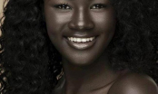 Cận cảnh cô gái da đen xinh đẹp nhất thế giới với là da kỳ lạ có 1 không 2