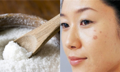 2 công thức trị thâm cực nhanh chỉ bằng cách sử dụng muối