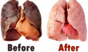Lọc sạch phổi trong 3 ngày kể cả hút thuốc lá lâu năm