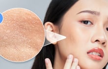 Cách để da căng bóng, mềm mịn, trời khô lạnh không lo nứt nẻ