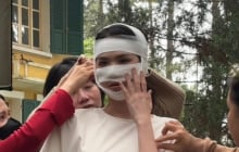 Hình ảnh Ngọc Trinh băng bó kín cả mặt gây hoang mang