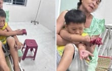 Cháu bé bị dập bàn tay nghi do điện thoại nổ khi đang sạc pin
