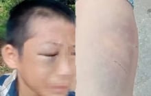 Bé trai nghi bị mẹ kế bạo hành nhiều lần: Người bố lên tiếng xin lỗi gia đình vợ cũ