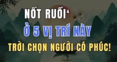 5 nốt ruồi báo trước Mệnh Son - Số Sướng, hưởng hết Tiền Tài tổ tiên