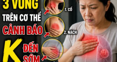 3 vùng trên cơ thể cảnh báo K đến sớm