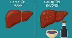 Cảnh báo: Loại gia vị quen thuộc này có thể âm thầm hại gan mà nhiều người Việt chưa biết