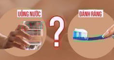 Sáng ngủ dậy nên đánh răng trước hay uống nước trước? 95% đang làm sai