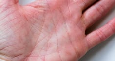 Tay có vân tam giác, giàu đến 90 tuổi: Bí ẩn đường chỉ tay hé lộ vận mệnh