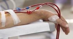 7 dấu hiệu suy thận giai đoạn cuối: Chủ quan tính mạng tính bằng tháng