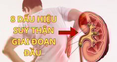 8 Dấu Hiệu Suy Thận Giai Đoạn Đầu: Phát hiện sớm cứu cả cuộc đời