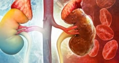 8 dấu hiệu cảnh báo suy thận giai đoạn đầu: Xem thường chạy thận cả đời