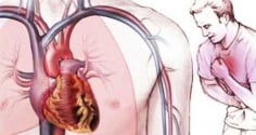 Vì sao tim ít khi bị ung thư? Lý do ít ai ngờ đằng sau sự “miễn nhiễm” đặc biệt của trái tim