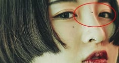 4 nốt ruồi hao tài: Ai có dù tài ba tới mấy cũng khó thoát nghèo