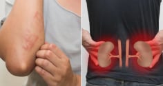 Cơ thể có 7 dấu hiệu này, cảnh báo bệnh thận, suy thận đang đến gần