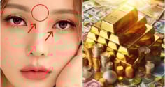 Người có 3 điểm này trên mặt Điềm Báo Phát Tài: Tiền vào như nước, thăng quan giàu có