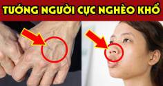 Người có 3 nét tướng này càng sống càng Bạc Phúc: Trẻ thì ốm đau hao tài, già thì cô độc nghèo khổ