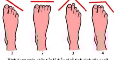 Nhìn chiều dài ngón chân đoán vận mệnh: Giàu sang hay nghèo khó đều hiện rõ