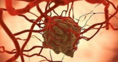 Tế bào ung thư sợ nhất điều gì? Chuyên gia chỉ ra loạt “điểm yếu chí mạng” ngăn chặn và tiêu diệt ung thư