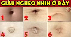 Nhìn tướng rốn biết tương lai bạn giàu sang hay nghèo khổ