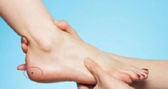 4 nốt ruồi trên bàn chân mang lại may mắn: Đừng dại xóa đi