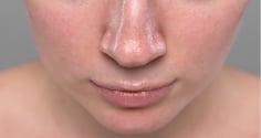 3 sai lầm chăm da mùa hè khiến da dễ đổ dầu, nổi mụn và nhanh lão hóa