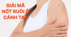 4 nốt ruồi trên cánh tay mang tới may mắn cho bạn: Đừng dại xóa đi
