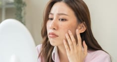 3 sai lầm chăm sóc da nhiều người mắc phải vào mùa hè khiến da đổ dầu, nổi mụn và nhanh lão hóa