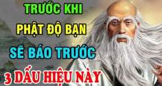3 dấu hiệu của người sắp trúng số phát tài trên mặt: Ai có thật đáng chúc mừng