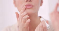 Môi khô, nứt nẻ kéo dài: Cách chăm sóc giúp đôi môi luôn mềm mại