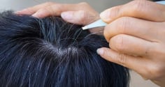 Nhổ tóc bạc, tóc sâu cho đỡ ngứa, coi chừng 4 tác hại khôn lường