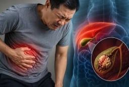 3 dấu hiệu cảnh báo viêm túi mật nặng