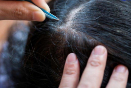 3 mối nguy hại khôn lường từ việc nhổ tóc bạc
