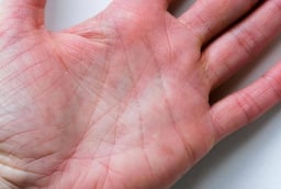 Tay có vân tam giác, giàu đến 90 tuổi: Bí ẩn đường chỉ tay hé lộ vận mệnh