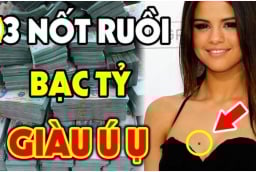 3 nốt ruồi là Hố Chôn Tiền: Ai có được hút bạc tỷ, đừng dại xóa đi