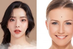 Người sở hữu 1 trong 3 nốt ruồi này đều mang phú quý, về giàu tiền đầy két, giàu 3 đời
