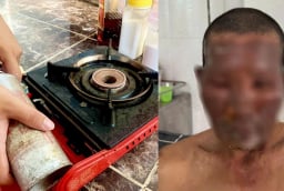 Bình gas mini phát nổ, 8 người nhập viện, lưu ý cách dùng để tránh họa bình gas mini